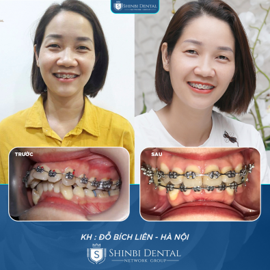 Khách hàng Đỗ Bích Liên